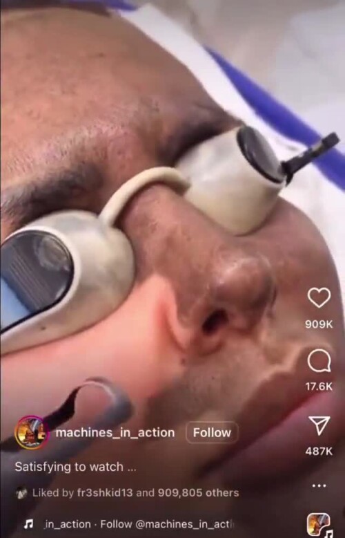 Rotating+leftfooted+colloquial a67922 11999455